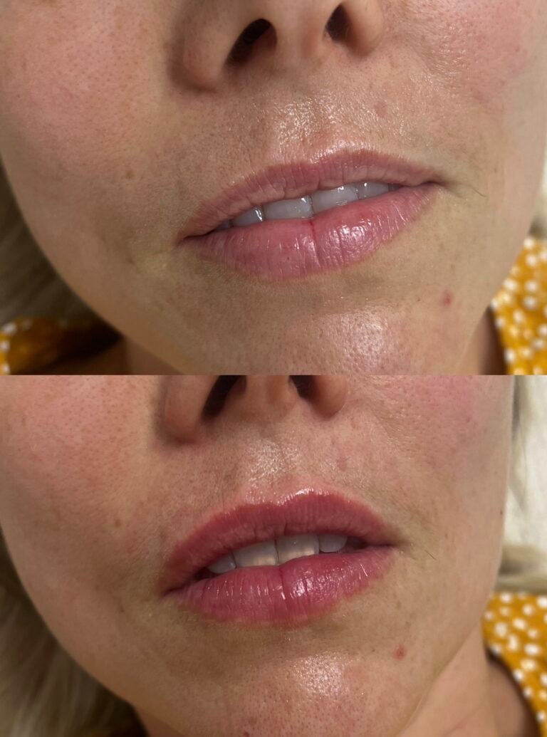 17118AF1-B6EA-4C3F-BB4A-C5B9AD714B37