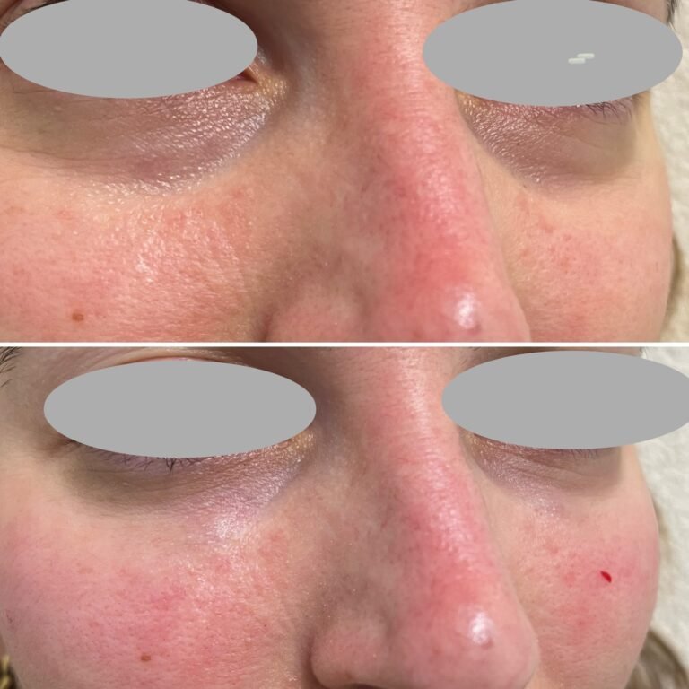 A0D35D13-71DB-4D14-AEBC-BA82F03848ED