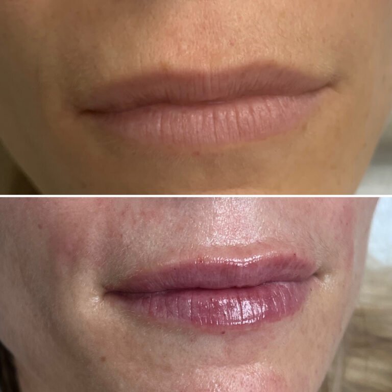 ADCD9685-6C35-441D-819B-8D39913B4F03