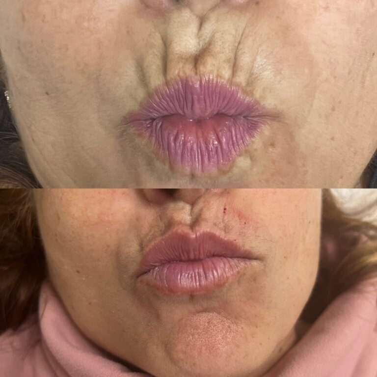 AE19A2E7-3527-48CA-96F7-E36998331FC0