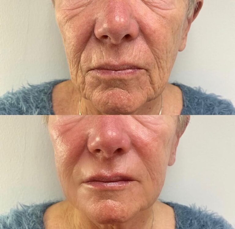 WhatsApp Image 2025-08-11 at 19.35